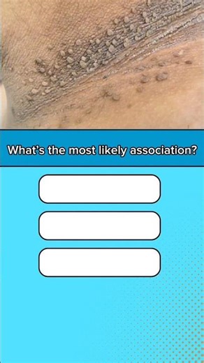 Clinical quiz 1 #medstudent #goodtoknow