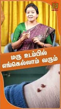 மரு உடம்பில் எங்கெல்லாம் வரும் || Dr.Jayaroopa | ASM INFO