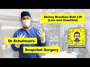 Live Skinny Brazilian Butt Lift (BBL) from SnapChat - Matthew Schulman, M.D