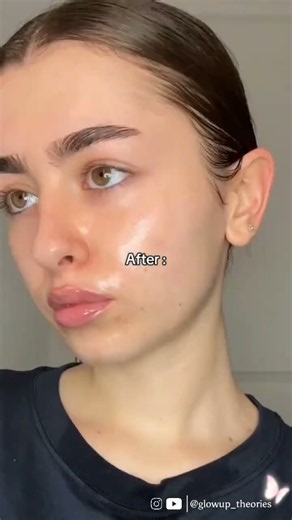 ✨ Remove Blackheads & Whiteheads at Home. #deepcleansing #fypシ #skincareroutine #glowingskin #fyp