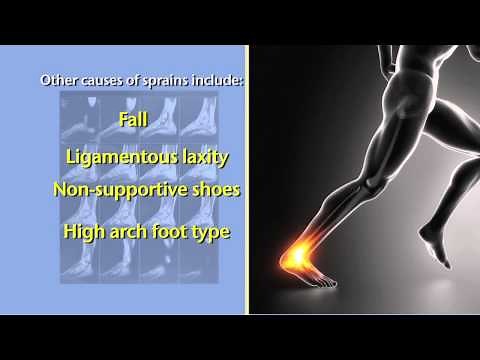 Ankle Sprains and Torn Ankle Ligaments