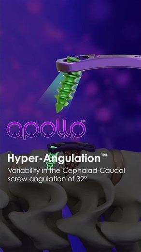 apollo™ - Freedom to Angulate, including Hyper-Angulation™