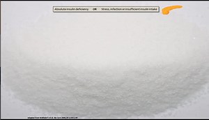 6.5K views · 52 reactions | DKA : Pathophysiology #diabetes #endocrinology #health #usmle #plab #medicalstudent #nursingstudent #nclex #mrcp #fcps #mrcpi #ukmla #nurse #paramedic #physicianassistant #physicianassociate #labtechnician #pharmacy #dietician #osteopathicmedicine #emergencymedicine #occupationaltherapy #familymedicine #generalpractice #primarycare #internalmedicine #psychology #physicaltherapy #physiotherapy #healthprofessionals | Medicine E-Library | Facebook