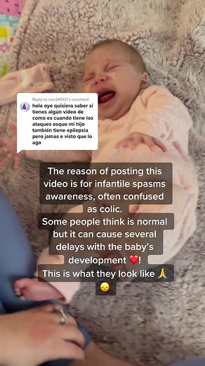 Understanding Infantile Spasms in Babies