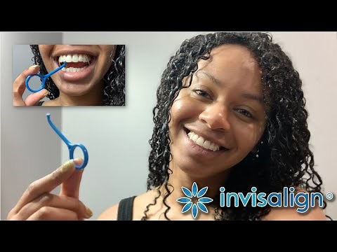 Invisalign: Removing Your Aligners