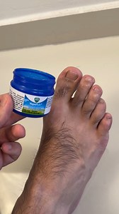 J'ai mis du Vicks dessus et ça a éliminé la mycose des ongles ! | Recettes Super Naturelles