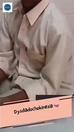Dr Medica Clinical Cases || Dysdiadochokinesia || Neurology || Clinical Medicine