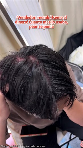 Control Oily Hair and Dandruff with Selenium Sulfide Shampoo