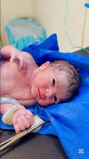 Newborn Baby’s First Cry 😢 | Heart-Touching Moment #cutebaby #baby