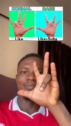 I’m normal, which one are you?😃 #remix #music #song