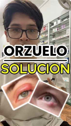 ¿Tienes un ORZUELO? 👁️ Por qué salen y cómo ALIVIARLO rápido 🚨