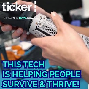 The world of prosthetics is growing rapidly! Incredible updates to design, medical science and robotics are making the development of artificial limbs more impressive than ever! Helping people live healthy, happy normal lives! #science #tech #mechanical #robotics | Ticker News
