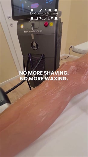 Experience Smooth Skin with Alma Soprano Titanium