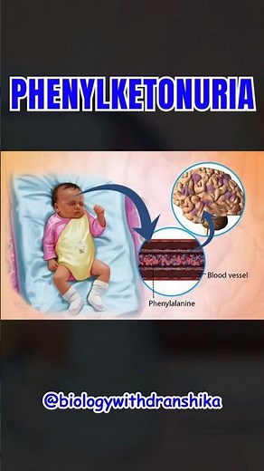 🧠 Phenylketonuria (PKU): A Silent Threat to Young Minds! #phenylketonuria #educationalvideo