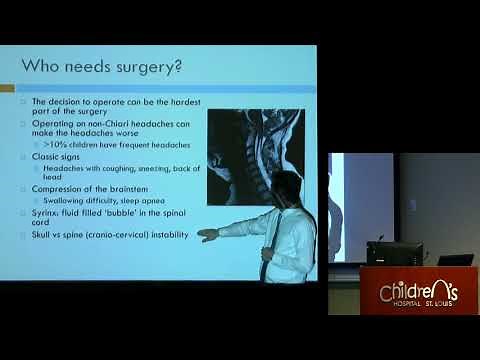 "Chiari Malformation, Chiari Decompression and Neurosurgery" - Sean D. McEvoy, MD