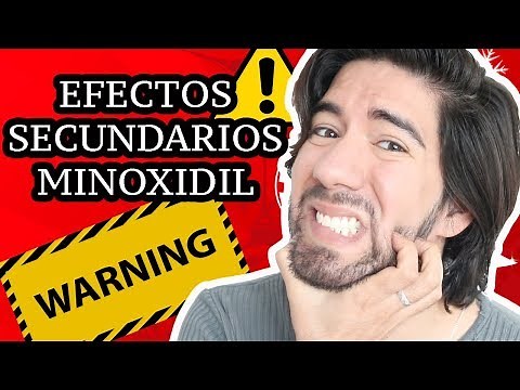 EFECTOS SECUNDARIOS DE MINOXIDIL - J.M. Montaño