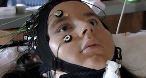 Groundbreaking system allows locked-in syndrome patients to communicate