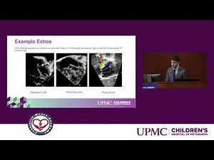 Staged Treatment of Ebstein Anomaly – Our Cone after Starnes Results - Ashraf Faaz, MD