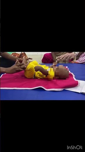 Extensor thrust-paediatric physiotherapy