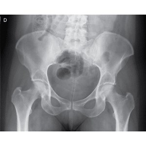 Anatomia radiológica | Imagenologia dos membros inferiores – Quadril por RX – Anatomia papel e caneta