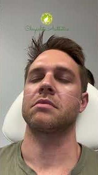 Cheek Fillers for Men