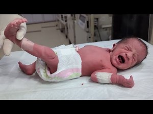 Abnormal Findings in Babies 🩷🍼 | Danger Signs Every Parent Must Know ❤️🐥 #baby #nicu #nicubaby