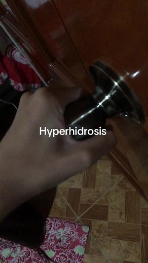 Hyperhidrosis: Causes, Symptoms & Treatments