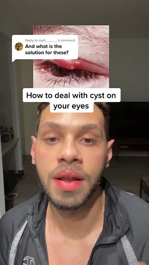 Effective Ways to Treat Eye Cysts: Compressions, Injections, and Surgery