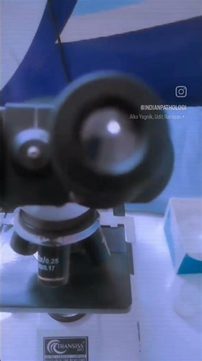 platelets count 🔬🔬