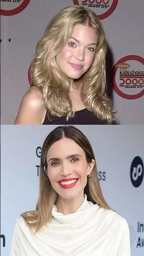 Before vs After: Mandy Moore’s Face Has Changed Completely