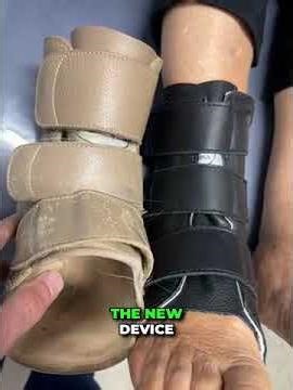 Could Your Weight Loss Mean New Braces? 🦶⚖️