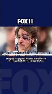 Man shot in face during Renee Good protest in Santa Ana | FOX 11 LA
