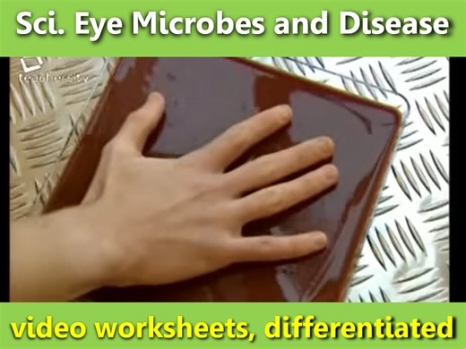 Scientific Eye: Microbes and Health video questions, differentiated x3 | Teaching Resources