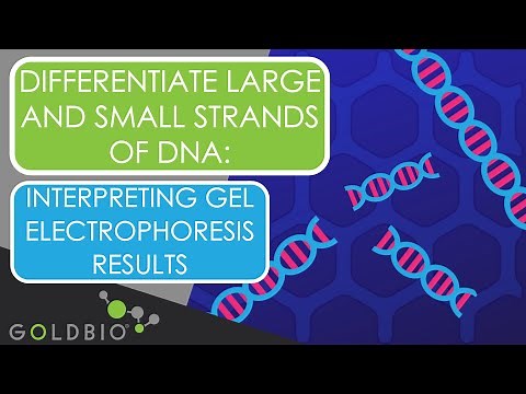 Differentiate Large And Small Strands Of DNA: Interpreting Gel Electrophoresis Results
