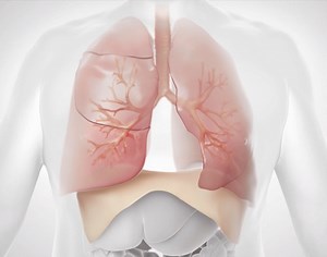 Zephyr Endobronchial Valve | Singing River Health System