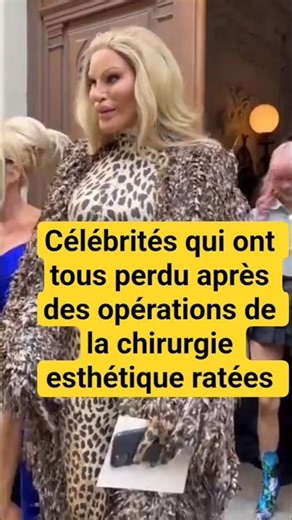 Celebrities who all lost weight after botched cosmetic surgery