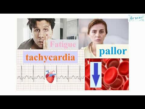 bone marrow suppression (English) - Medical terminology for medical students -