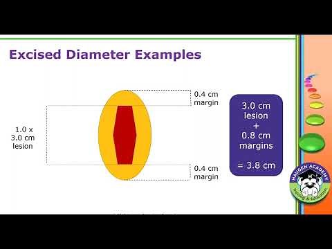 HCGTV: Webinar - Tackle Your Lesion Coding Troubles