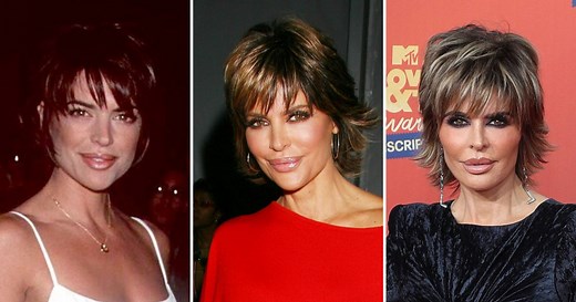 'RHOBH' Lisa Rinna Plastic Surgery Transformation Photos