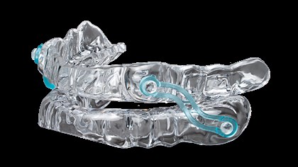 Silent Nite – Oral Appliance for Sleep Apnea