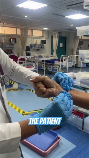 Allen Test explained in 20 seconds | Must-know before ABG #ABG #medical