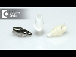 What is a Cement Retained Implant crown? - Dr. Shambhu H Shivanna