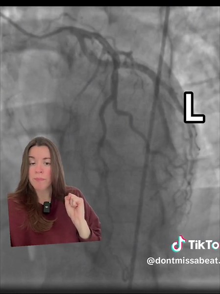 LAO Cranial View: Understanding Anatomy and Imaging