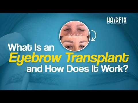 What Is an Eyebrow Transplant and How Does It Work?