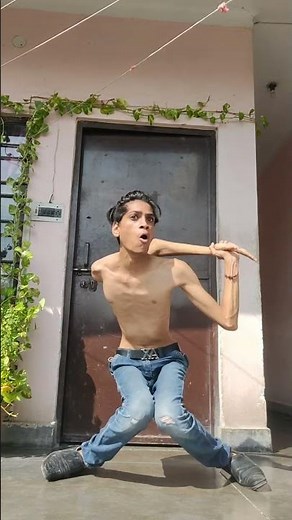 Scary bone breaking dance