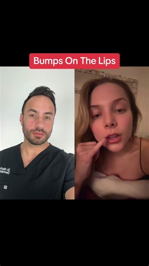 Boyfriend's Facial Hair: Cause of Lip Pimples?