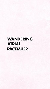 7.3K views · 14 reactions | Wandering Atrial Pacemaker . . Great post by @medzcool . . #nurse #nursing #cardiacnurse #aprn #rn #rnlife | CardioVisual | Facebook