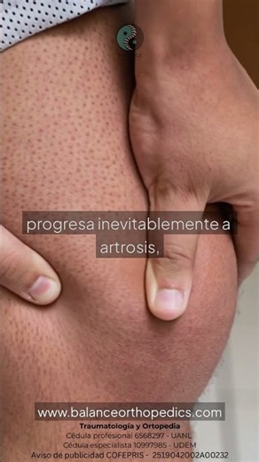 🦴 No blood means no repair — how cartilage works.