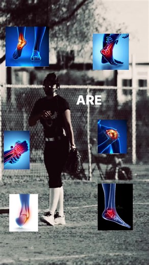 Dealing with a Sprained Ankle in Softball