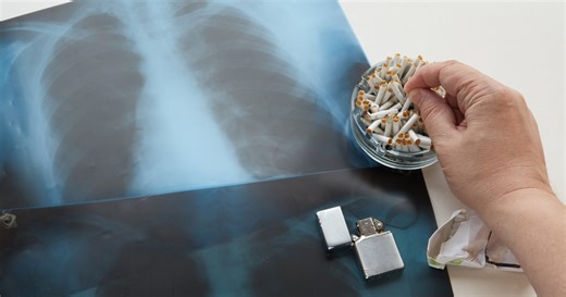 Płuca palacza wyglądają inaczej. Jak zmieniają się przez palenie?